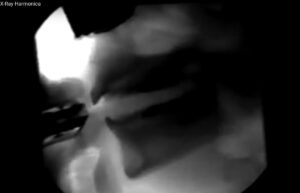Experimental studies by Drs. Henry T. Bahnson and James F. Antaki, University of Pittsburgh, Department of Surgery. Mission: to see inside stuff inside the mouth when you play the harmonica. ca 1992