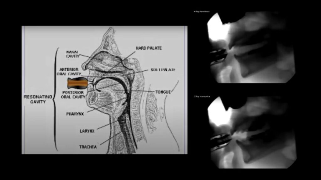 Experimental studies by Drs. Henry T. Bahnson and James F. Antaki, University of Pittsburgh, Department of Surgery. Mission: to see inside stuff inside the mouth when you play the harmonica. ca 1992